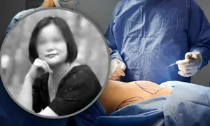 Vụ kiện tử vong sau 6 ca phẫu thuật thẩm mỹ trong 24 giờ Vụ kiện tử vong sau 6 ca phẫu thuật thẩm mỹ trong 24 giờ