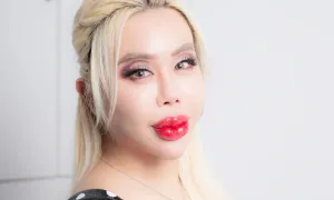 Bị bắt nạt, chàng trai Nhật chi hơn 17 tỷ đồng phẫu thuật thẩm mỹ